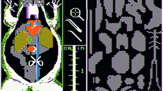 Screenshot Operation Frog 2